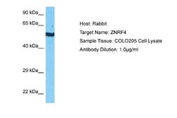 ZNRF4 Antibody, Novus Biologicals 100 &mu;L | Buy Online | Novus Biologicals | Fisher Scientific